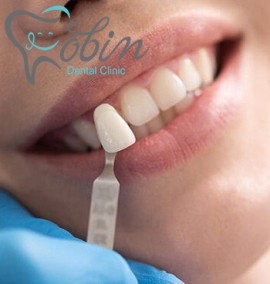 معرفی خدمات لمینت دندان